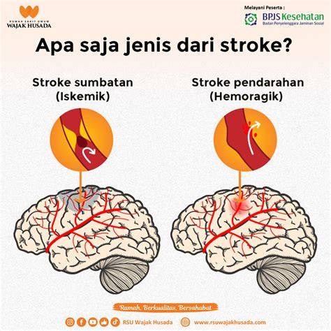 Galeri foto VideO MeMeK SmA peta hafal dan mudah dicari untuk stroke di tersedia di beranda platform
